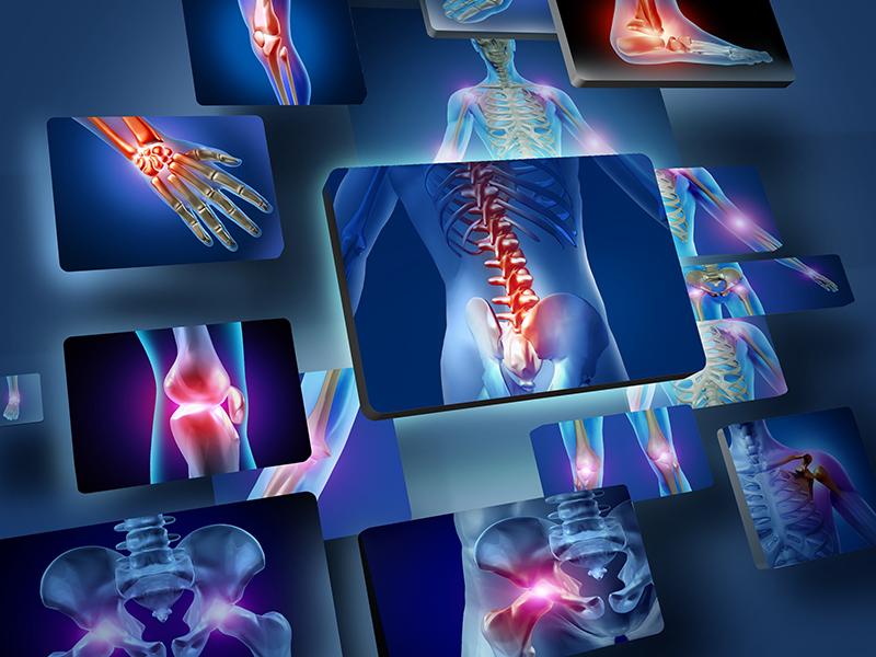 A new and refined injectable treatment for musculoskeletal disorders - bioscaffold properties of collagen and its clinical use. Part 1